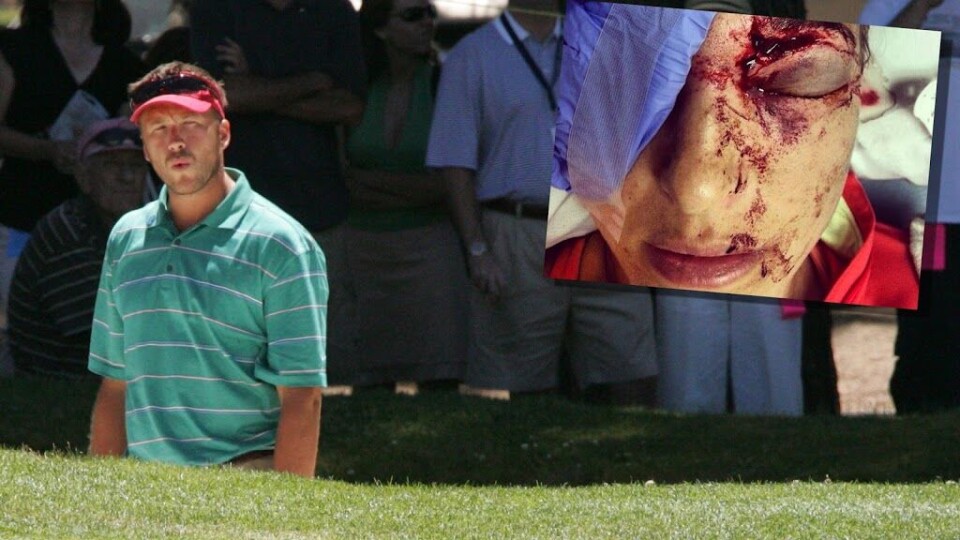 Alpint-stjerne traff kona med golfball