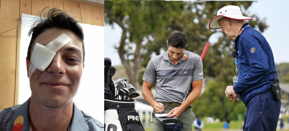 Hovland trakk seg fra U.S. Open med øyeskade